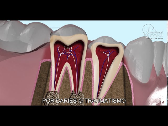 Cuidado dental durante el embarazo para prevenir enfermedades periodontales