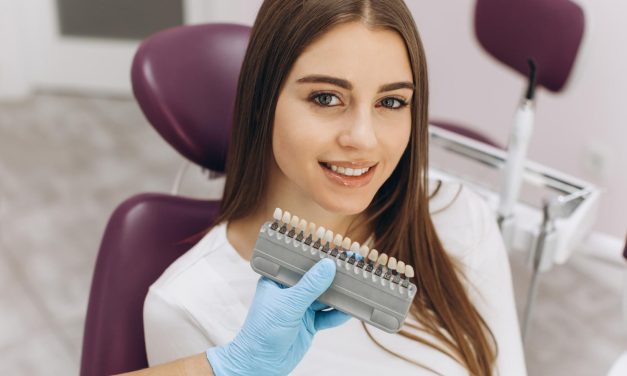 Tendencias en Diseño de Sonrisa: Lo Último en Estética Dental