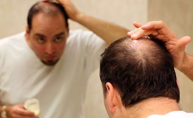 Causas de la caída de cabello